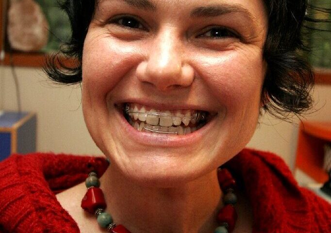 What are the best link building strategies for Sydney SEO?